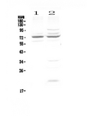 CHM / REP1 Antibody - Western blot - Anti-CHM antibody