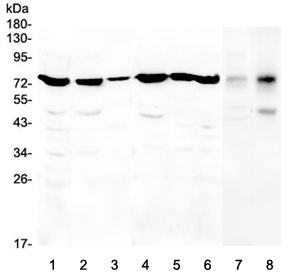 CHM / REP1 Antibody - Western blot testing of human 1) HeLa, 2) U-87 MG, 3) A431, 4) K562, 5) A549, 6) Caco-2, 7) rat stomach and 8) mouse stomach lysate with CHM antibody at 0.5ug/ml. Predicted molecular weight ~73 kDa.