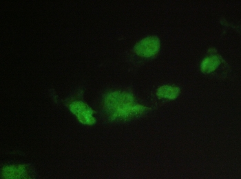 CHM / REP1 Antibody - IF/ICC staining of FFPE human A431 cells with CHM antibody (green) at 2ug/ml. HIER: steam section in pH6 citrate buffer for 20 min.
