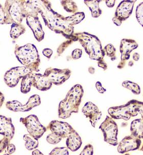 CHM / REP1 Antibody - IHC staining of FFPE human placenta with CHM antibody at 1ug/ml. HIER: boil tissue sections in pH6, 10mM citrate buffer, for 10-20 min and allow to cool before testing.