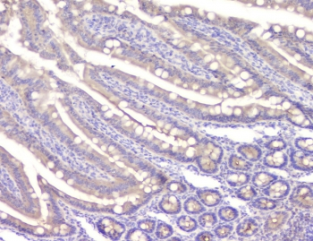 CHM / REP1 Antibody - IHC staining of FFPE rat small intestine with CHM antibody at 1ug/ml. HIER: boil tissue sections in pH6, 10mM citrate buffer, for 10-20 min and allow to cool before testing.