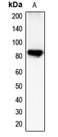 CHML Antibody - Western blot analysis of CHML expression in COLO205 (A) whole cell lysates.