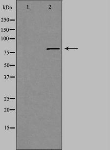 CHML Antibody - Western blot analysis of extracts of COLO cells using CHML antibody. The lane on the left is treated with the antigen-specific peptide.