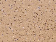 CHML Antibody - Immunochemical staining of human CHML in human brain with rabbit polyclonal antibody at 1:300 dilution, formalin-fixed paraffin embedded sections.