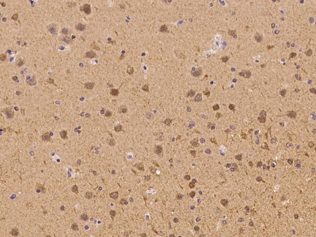 CHML Antibody - Immunochemical staining of human CHML in human brain with rabbit polyclonal antibody at 1:300 dilution, formalin-fixed paraffin embedded sections.