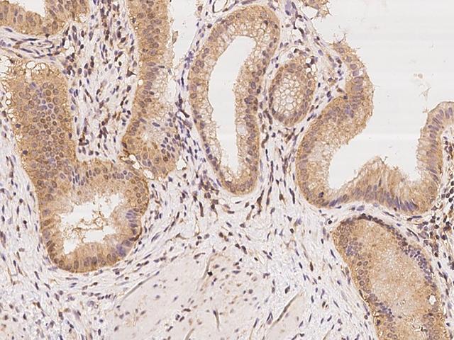 CHML Antibody - Immunochemical staining of human CHML in human gallbladder with rabbit polyclonal antibody at 1:300 dilution, formalin-fixed paraffin embedded sections.