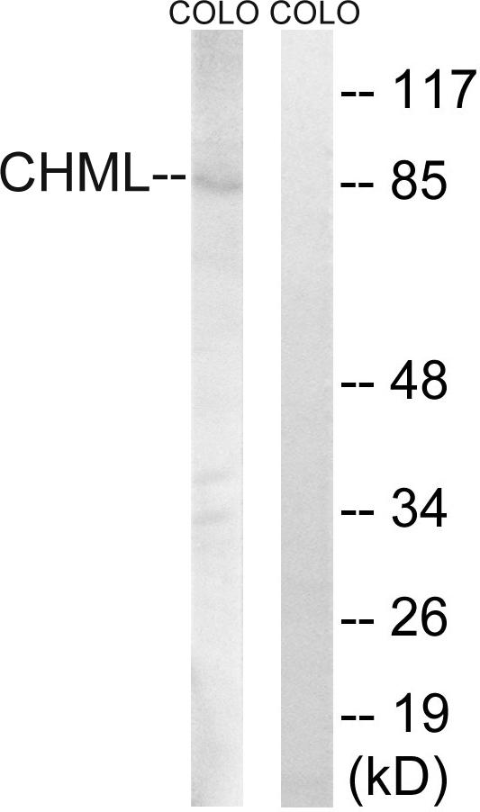 CHML Antibody - Western blot analysis of extracts from COLO cells, using CHML antibody.