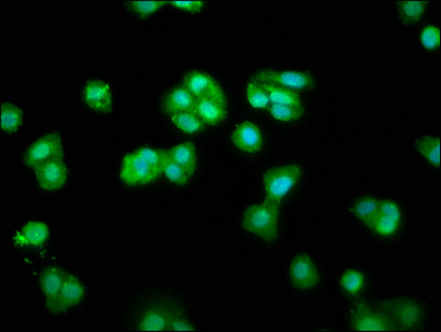 CHMP1A Antibody - Immunofluorescence staining of HepG2 cells at a dilution of 1:66, counter-stained with DAPI. The cells were fixed in 4% formaldehyde, permeabilized using 0.2% Triton X-100 and blocked in 10% normal Goat Serum. The cells were then incubated with the antibody overnight at 4 °C.The secondary antibody was Alexa Fluor 488-congugated AffiniPure Goat Anti-Rabbit IgG (H+L) .