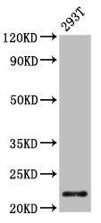 CHMP1A Antibody - Western Blot Positive WB detected in: 293T whole cell lysate All lanes: CHMP1A antibody at 4.2µg/ml Secondary Goat polyclonal to rabbit IgG at 1/50000 dilution Predicted band size: 22, 8 kDa Observed band size: 22 kDa