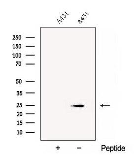CHMP1A Antibody - Western blot analysis of extracts of A431 cells using CHMP1A antibody. The lane on the left was treated with blocking peptide.