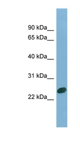 CHMP1B Antibody - CHMP1B antibody Western blot of Fetal Heart lysate. This image was taken for the unconjugated form of this product. Other forms have not been tested.