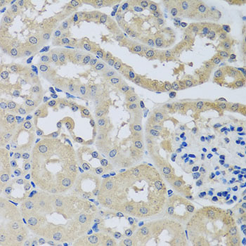 CHMP1B Antibody - Immunohistochemistry of paraffin-embedded mouse kidney tissue.