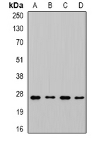 CHMP1B Antibody - Western blot analysis of CHMP1B expression in MCF7 (A); SKOV3 (B); mouse liver (C); mouse brain (D) whole cell lysates.