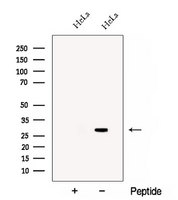 CHMP1B Antibody - Western blot analysis of extracts of B16F10 cells using CHMP1B antibody. The lane on the left was treated with blocking peptide.