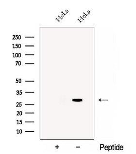 CHMP1B Antibody - Western blot analysis of extracts of B16F10 cells using CHMP1B antibody. The lane on the left was treated with blocking peptide.