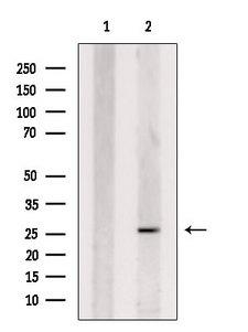 CHMP1B Antibody