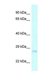 CHMP2A Antibody - CHMP2A antibody Western blot of 293T Cell lysate. Antibody concentration 1 ug/ml.  This image was taken for the unconjugated form of this product. Other forms have not been tested.