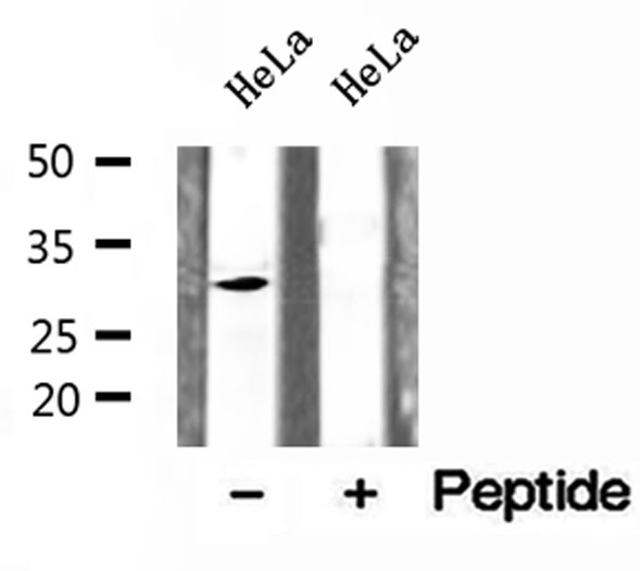 CHMP2A Antibody - Western blot analysis of extracts of HeLa cells using CHMP2A antibody.
