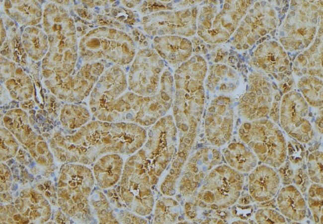 CHMP2A Antibody - 1:100 staining mouse kidney tissue by IHC-P. The sample was formaldehyde fixed and a heat mediated antigen retrieval step in citrate buffer was performed. The sample was then blocked and incubated with the antibody for 1.5 hours at 22°C. An HRP conjugated goat anti-rabbit antibody was used as the secondary.
