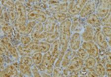 CHMP2A Antibody - 1:100 staining mouse kidney tissue by IHC-P. The sample was formaldehyde fixed and a heat mediated antigen retrieval step in citrate buffer was performed. The sample was then blocked and incubated with the antibody for 1.5 hours at 22°C. An HRP conjugated goat anti-rabbit antibody was used as the secondary.