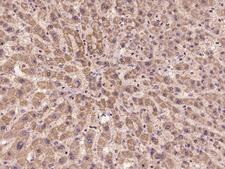 CHMP2A Antibody - Immunochemical staining of human CHMP2A in human liver with rabbit polyclonal antibody at 1:100 dilution, formalin-fixed paraffin embedded sections.