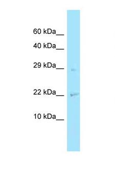 CHMP2A Antibody - CHMP2A antibody Western blot of Fetal Lung lysate. Antibody concentration 1 ug/ml.  This image was taken for the unconjugated form of this product. Other forms have not been tested.