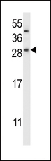 CHMP2B Antibody - CHMP2B Antibody western blot of SK-BR-3 cell line lysates (35 ug/lane). The CHMP2B antibody detected the CHMP2B protein (arrow).