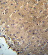 CHMP2B Antibody - CHMP2B Antibody immunohistochemistry of formalin-fixed and paraffin-embedded human liver tissue followed by peroxidase-conjugated secondary antibody and DAB staining.