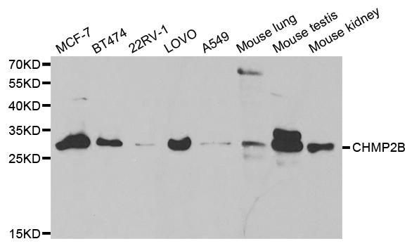 CHMP2B Antibody - Western blot analysis of extracts of various cell lines.