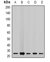 CHMP2B Antibody - Western blot analysis of CHMP2B expression in MCF7 (A); LOVO (B); A549 (C); mouse lung (D); mouse kidney (E) whole cell lysates.