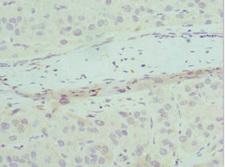 CHMP2B Antibody - Immunohistochemistry of paraffin-embedded human liver tissue at dilution 1:100