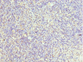 CHMP2B Antibody - Immunohistochemistry of paraffin-embedded Human thymus tissue at dilution 1:100