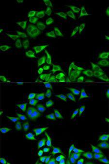 CHMP2B Antibody - Immunofluorescence analysis of MCF-7 cells using CHMP2B antibody. Blue: DAPI for nuclear staining.