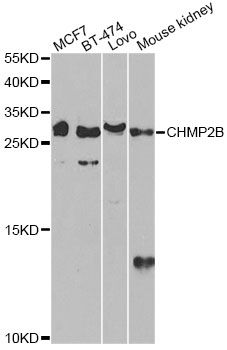 CHMP2B Antibody - Western blot analysis of extracts of various cell lines, using CHMP2B antibody at 1:1000 dilution. The secondary antibody used was an HRP Goat Anti-Rabbit IgG (H+L) at 1:10000 dilution. Lysates were loaded 25ug per lane and 3% nonfat dry milk in TBST was used for blocking. An ECL Kit was used for detection and the exposure time was 30s.