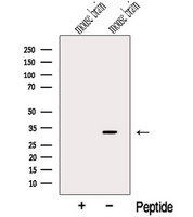 CHMP2B Antibody - Western blot analysis of extracts of COLO205 cells using CHMP2B antibody. The lane on the left was treated with blocking peptide.