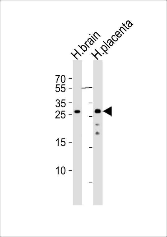 CHMP4A Antibody - Western blot of lysates from human brain and human placenta tissue (from left to right), using CHMP4A antibody diluted at 1:1000 at each lane. A goat anti-rabbit IgG H&L (HRP) at 1:10000 dilution was used as the secondary antibody. Lysates at 20 ug per lane.