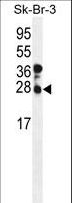 CHMP4B Antibody - Western blot of CHMP4B Antibody in SK-BR-3 cell line lysates (35 ug/lane). CHMP4B (arrow) was detected using the purified antibody.