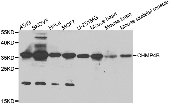 CHMP4B Antibody - Western blot analysis of extracts of various cell lines.