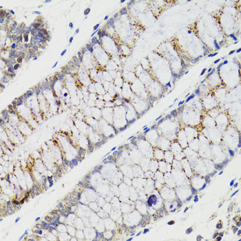 CHMP4B Antibody - Immunohistochemistry of paraffin-embedded human rectum tissue.
