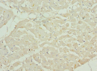 CHMP4B Antibody - Immunohistochemistry of paraffin-embedded human heart tissue at dilution 1:100