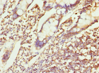 CHMP4B Antibody - Immunohistochemistry of paraffin-embedded human small intestine at dilution 1:100