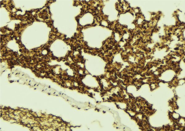 CHMP4B Antibody - 1:100 staining mouse lung tissue by IHC-P. The sample was formaldehyde fixed and a heat mediated antigen retrieval step in citrate buffer was performed. The sample was then blocked and incubated with the antibody for 1.5 hours at 22°C. An HRP conjugated goat anti-rabbit antibody was used as the secondary.