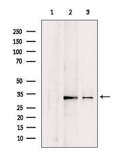CHMP4B Antibody - Western blot analysis of extracts of various samples using CHMP4B antibody. Lane 1: rat brain treated with blocking peptide. Lane 2: rat brain; Lane 3: mouse brain;