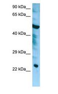 CHMP6 Antibody - CHMP6 antibody Western Blot of HepG2.  This image was taken for the unconjugated form of this product. Other forms have not been tested.