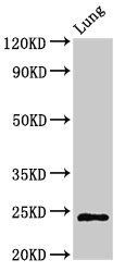 CHMP6 Antibody - Western Blot Positive WB detected in: Rat lung tissue All lanes: CHMP6 antibody at 3µg/ml Secondary Goat polyclonal to rabbit IgG at 1/50000 dilution Predicted band size: 24 kDa Observed band size: 24 kDa