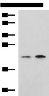 CHMP6 Antibody - Western blot analysis of Jurkat Raji cell lysates  using CHMP6 Polyclonal Antibody at dilution of 1:1000