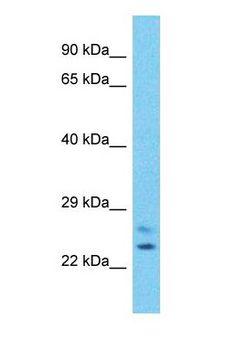 CHMP6 Antibody - Western blot of CHMP6 Antibody with human Jurkat Whole Cell lysate.  This image was taken for the unconjugated form of this product. Other forms have not been tested.