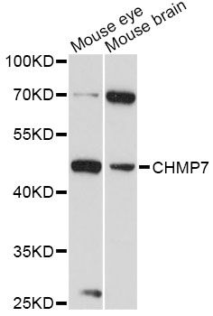 CHMP7 Antibody - Western blot analysis of extracts of various cell lines, using CHMP7 antibody at 1:3000 dilution. The secondary antibody used was an HRP Goat Anti-Rabbit IgG (H+L) at 1:10000 dilution. Lysates were loaded 25ug per lane and 3% nonfat dry milk in TBST was used for blocking. An ECL Kit was used for detection and the exposure time was 90s.
