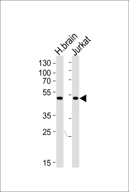 CHN1 Antibody - Western blot of lysates from human brain tissue lysate and Jurkat cell line (from left to right), using CHN1 Antibody. Antibody was diluted at 1:1000 at each lane. A goat anti-rabbit IgG H&L (HRP) at 1:5000 dilution was used as the secondary antibody. Lysates at 35ug per lane.