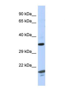 CHN1 Antibody - CHN1 antibody Western blot of Fetal Thymus lysate. Antibody concentration 1 ug/ml.  This image was taken for the unconjugated form of this product. Other forms have not been tested.